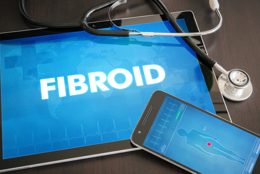 Uterine Fibroids – Heal Them In An Ayurvedic Way